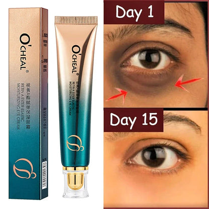 Retinol Anti-Wrinkle Eye Cream for Fine Lines by HitMyNeed