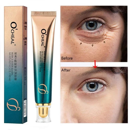 Retinol Anti-Wrinkle Eye Cream for Fine Lines by HitMyNeed