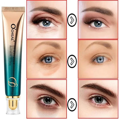 Retinol Anti-Wrinkle Eye Cream for Fine Lines by HitMyNeed