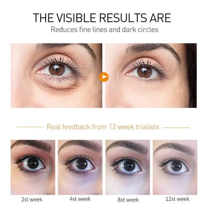 Retinol Anti-Wrinkle Eye Cream for Fine Lines by HitMyNeed