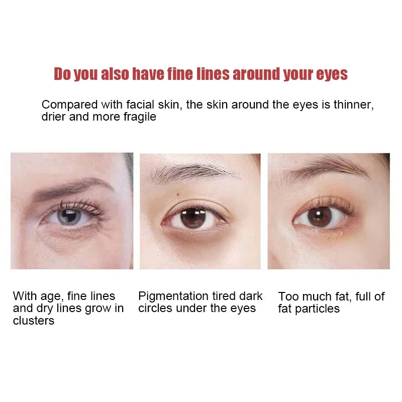 Retinol Anti-Wrinkle Eye Cream for Fine Lines by HitMyNeed