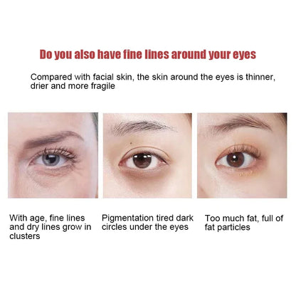 Retinol Anti-Wrinkle Eye Cream for Fine Lines by HitMyNeed