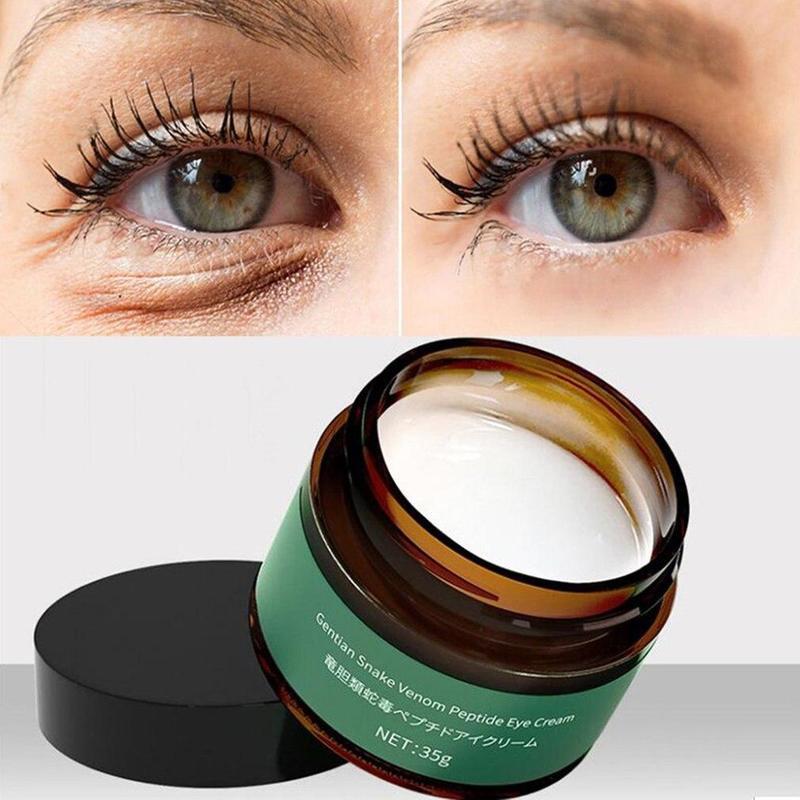 Retinol Eye Cream for Bags, Puffiness & Dark Circles 15g by HitMyNeed