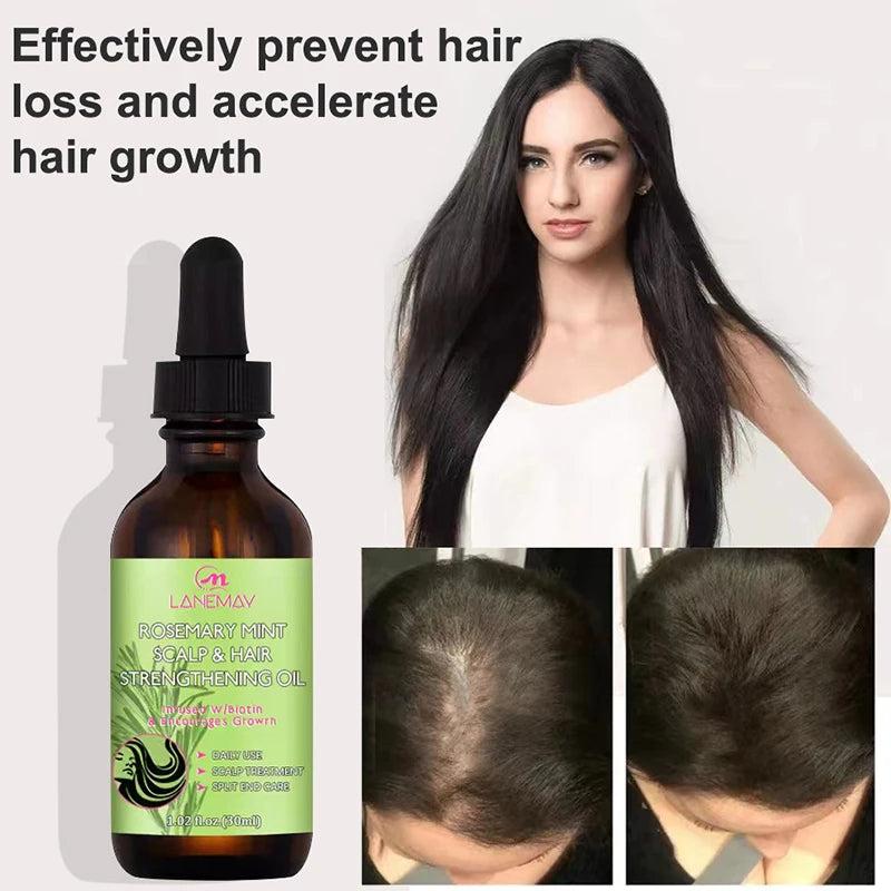 Rosemary Hair Growth Oil for Thicker, Fuller Hair by HitMyNeed