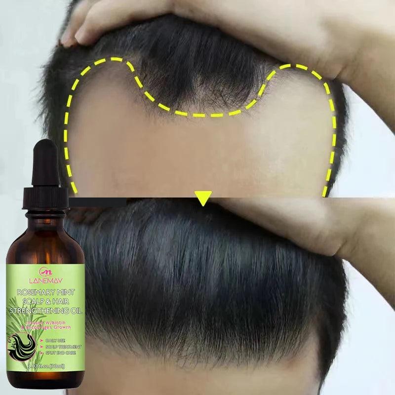 Rosemary Hair Growth Oil for Thicker, Fuller Hair by HitMyNeed