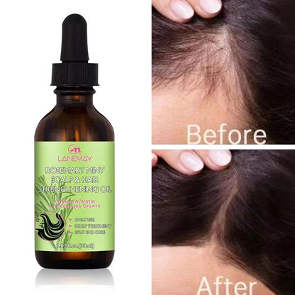 Rosemary Hair Growth Oil for Thicker, Fuller Hair by HitMyNeed