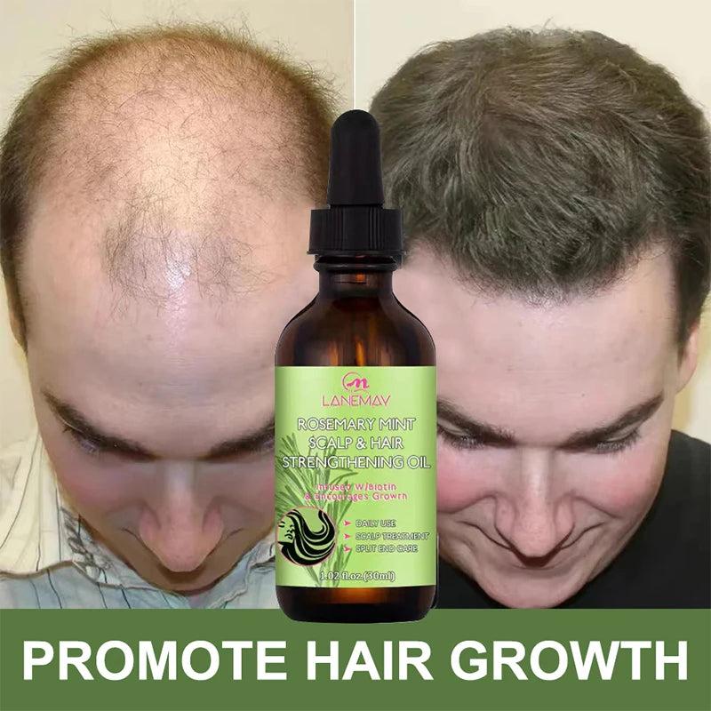 Rosemary Hair Growth Oil for Thicker, Fuller Hair by HitMyNeed