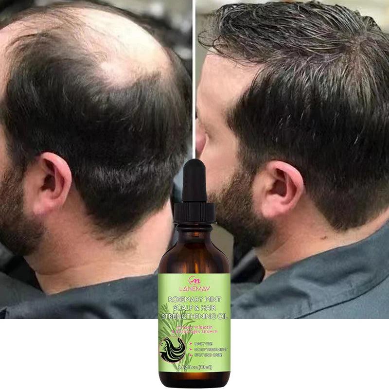 Rosemary Hair Growth Oil for Thicker, Fuller Hair One by HitMyNeed