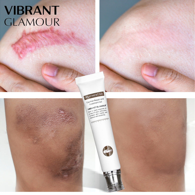 Scar & Acne Mark Treatment Gel with Aloe & Centella by HitMyNeed