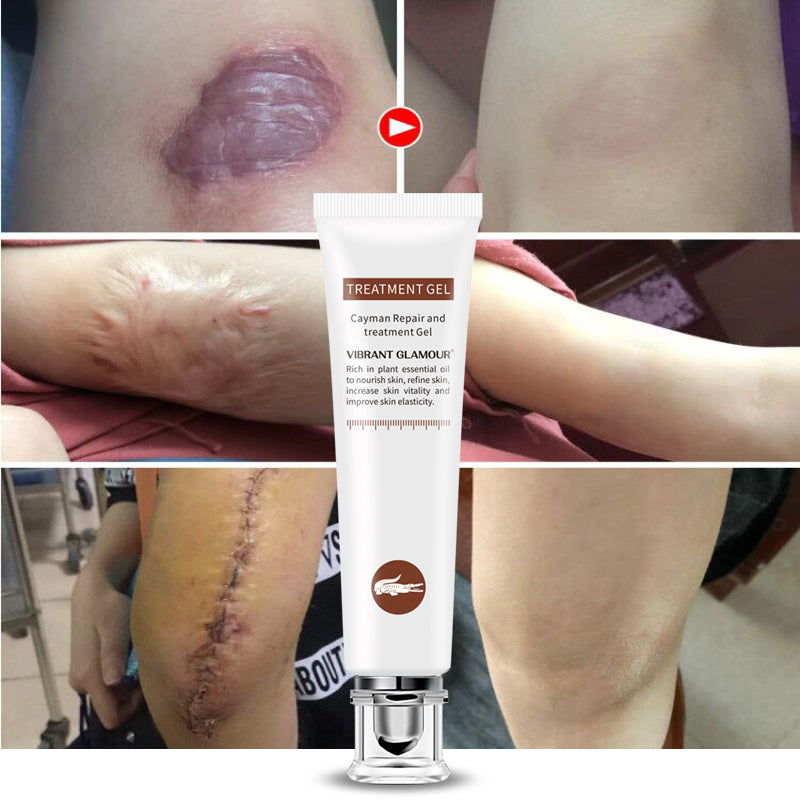Scar & Acne Mark Treatment Gel with Aloe & Centella by HitMyNeed