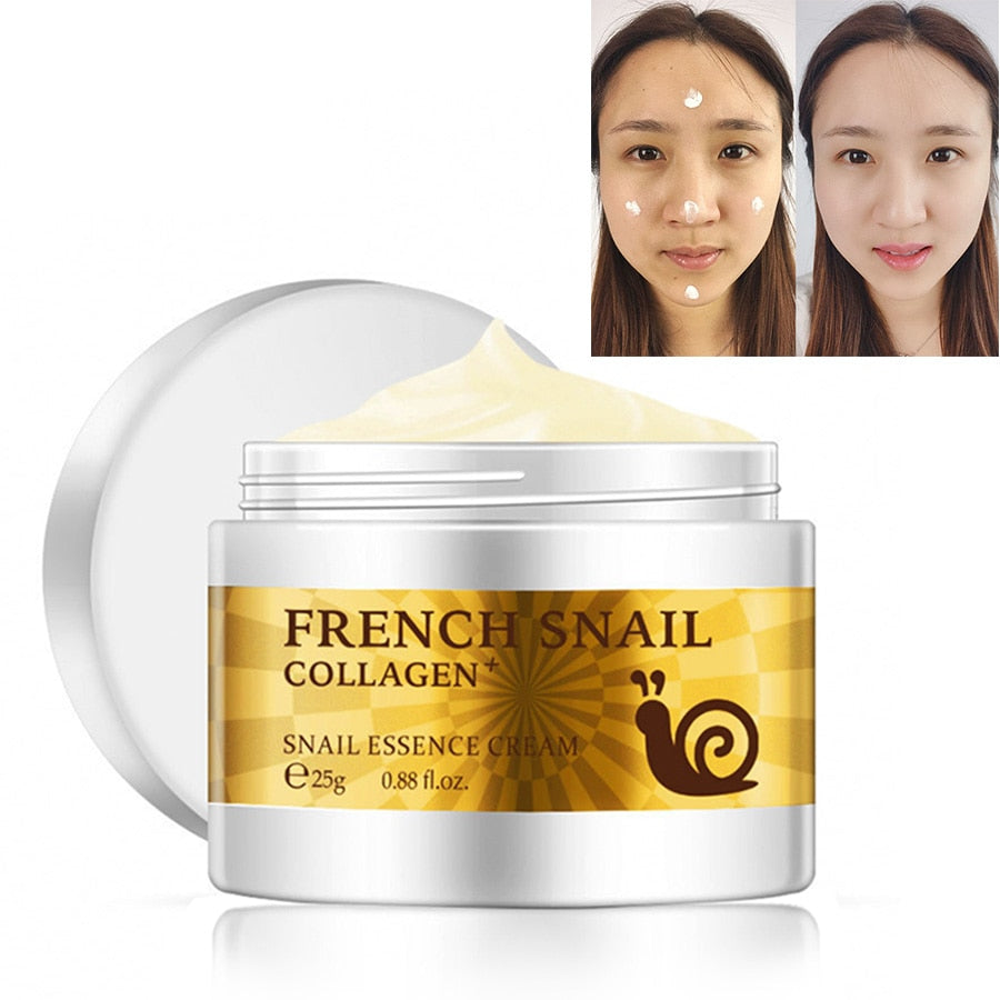 Scar Removal Collagen Face Cream 25g by HitMyNeed