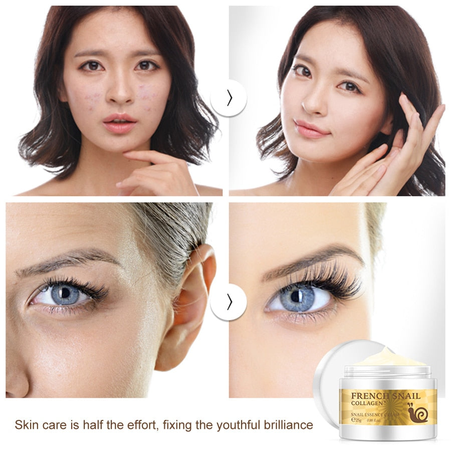 Scar Removal Collagen Face Cream 25g by HitMyNeed