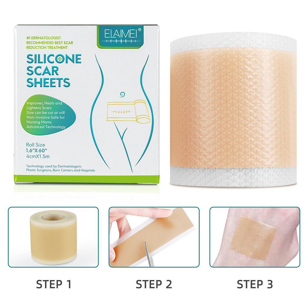 Self Adhesive Silicone Scar Tape 4cm x 1.5m by HitMyNeed