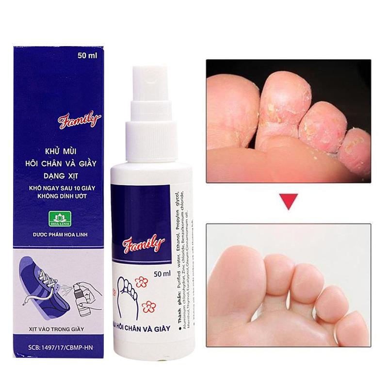 Shoe Deodorizer Spray Odor Eliminator 50ml by HitMyNeed