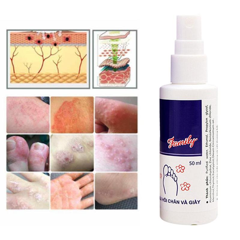 Shoe Deodorizer Spray Odor Eliminator 50ml by HitMyNeed