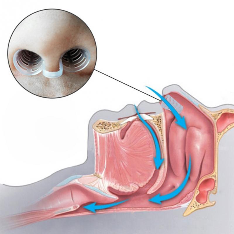 Silicone Anti-Snore Nasal Stopper by HitMyNeed