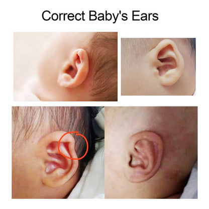 Silicone Baby Ear Corrector Tape Roll by HitMyNeed