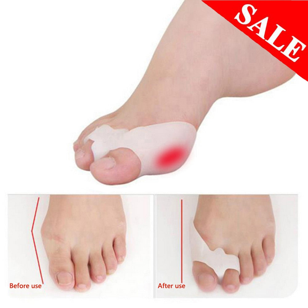 Silicone Bunion Pads Hallux Valgus Correctors (2pcs) by HitMyNeed