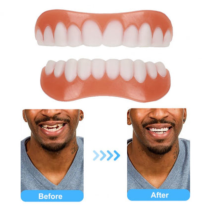 Silicone Cosmetic Fake Teeth Cover - Natural Look by HitMyNeed