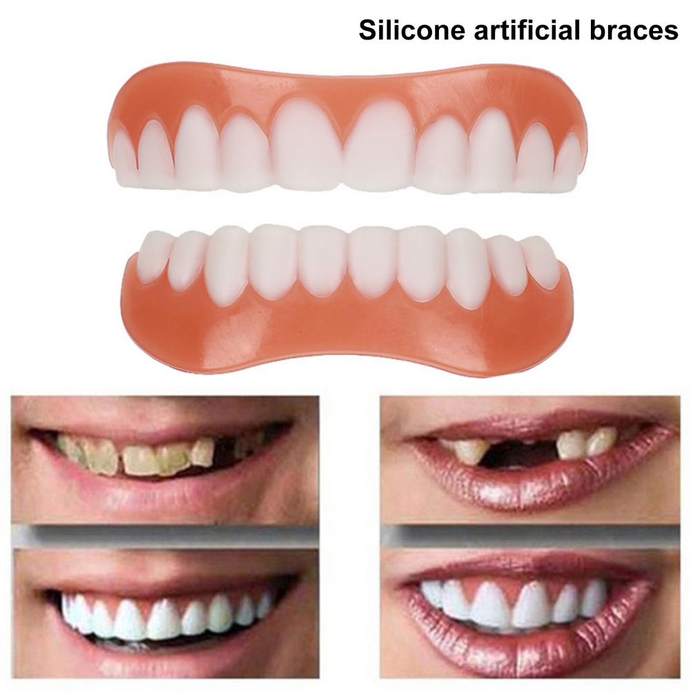 Silicone Cosmetic Fake Teeth Cover - Natural Look by HitMyNeed