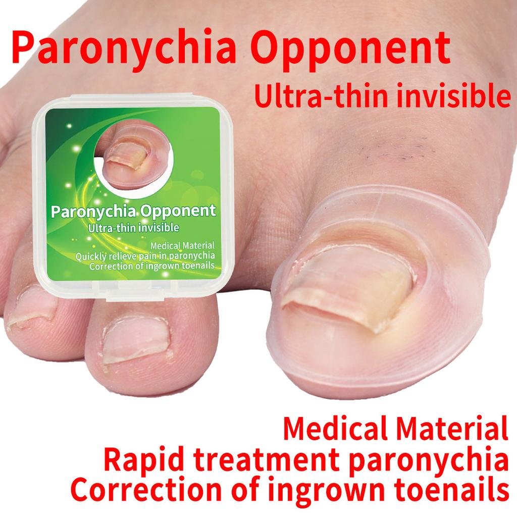 Silicone Ingrown Toenail Correction Sleeves (2pcs) by HitMyNeed