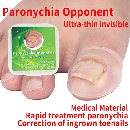 Silicone Ingrown Toenail Correction Sleeves (2pcs) by HitMyNeed