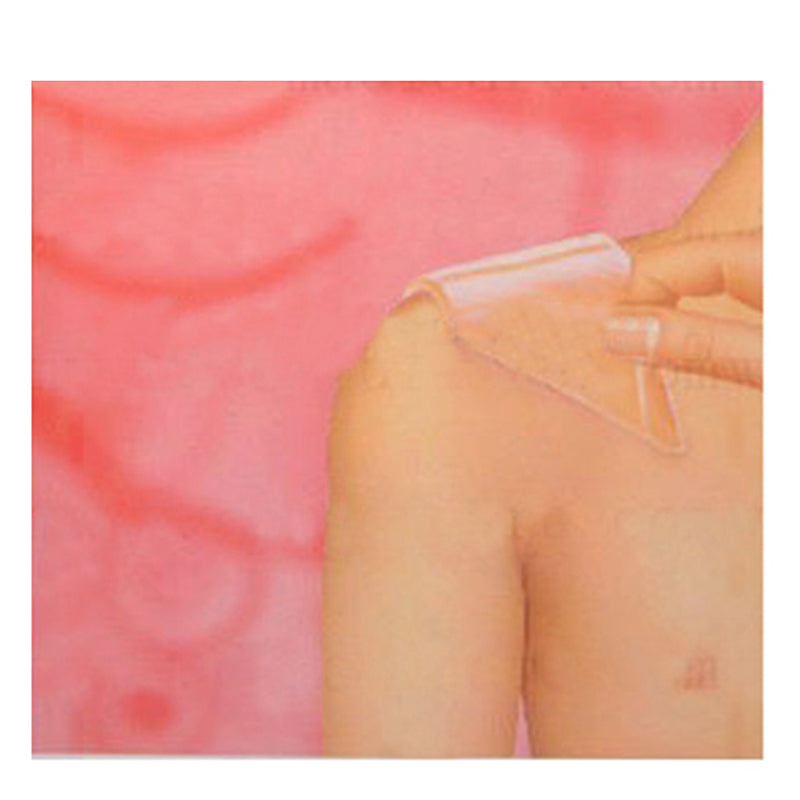Silicone Scar Removal Patch for Old and New Scars by HitMyNeed