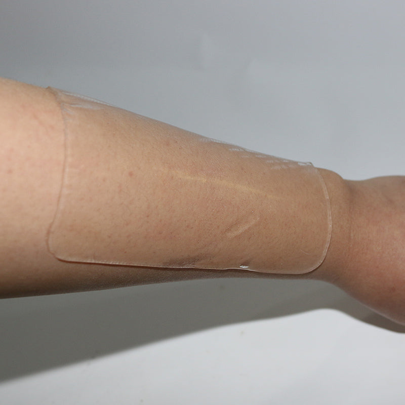 Silicone Scar Removal Patch for Old and New Scars by HitMyNeed