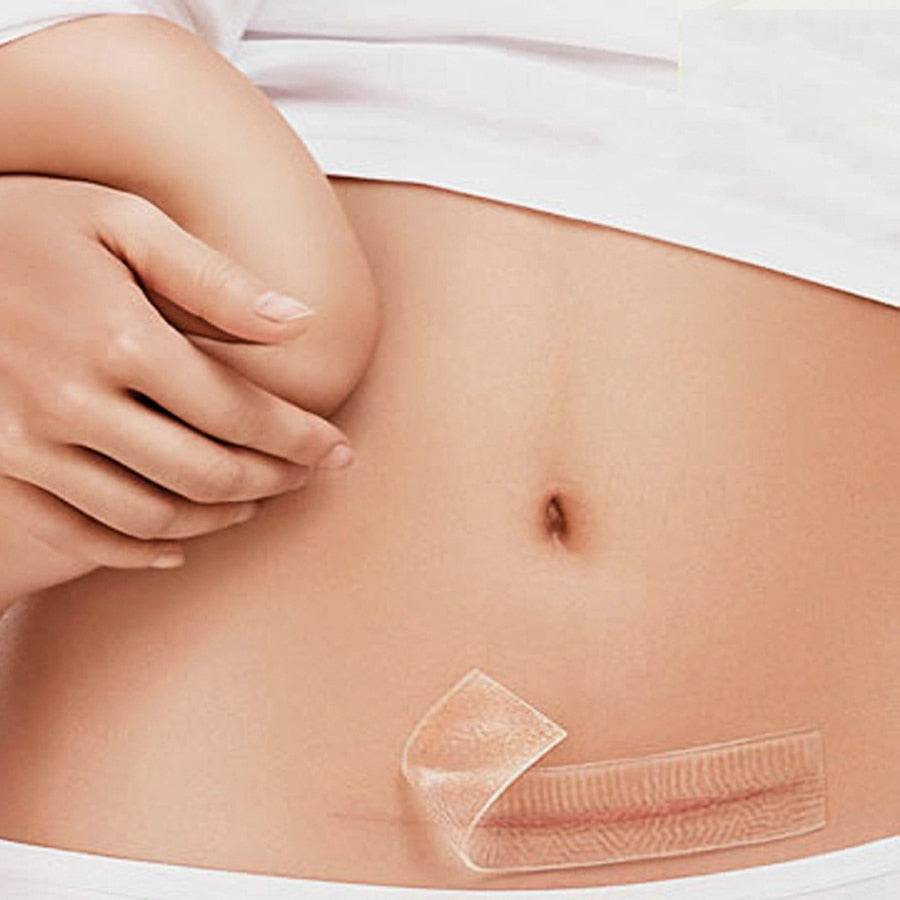 Silicone Scar Sheets Reusable Patch 3.5 x 12 cm by HitMyNeed