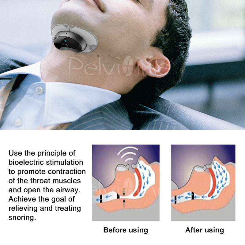 Smart Anti-Snoring Device with App Tracking by HitMyNeed