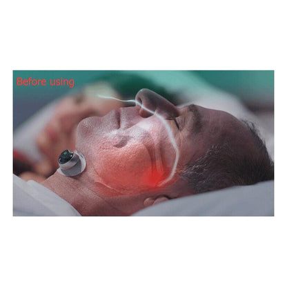 Smart Anti-Snoring Device with App Tracking by HitMyNeed