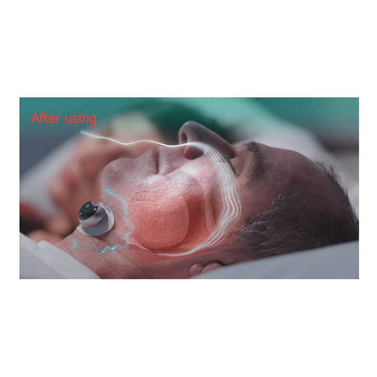 Smart Anti-Snoring Device with App Tracking by HitMyNeed