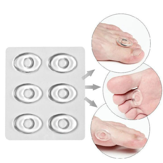 Soft Gel Callus Pads for Feet Support (6 Pack) by HitMyNeed