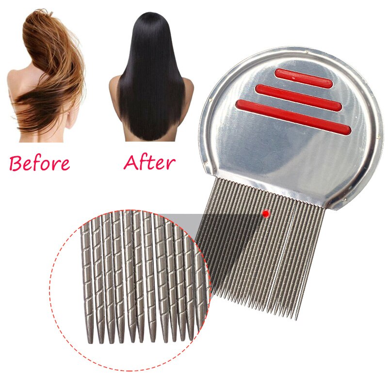 Stainless Steel Lice and Nit Removal Comb by HitMyNeed