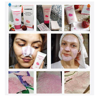 Strawberry Nose Pore Strips Blackhead Remover Set by HitMyNeed