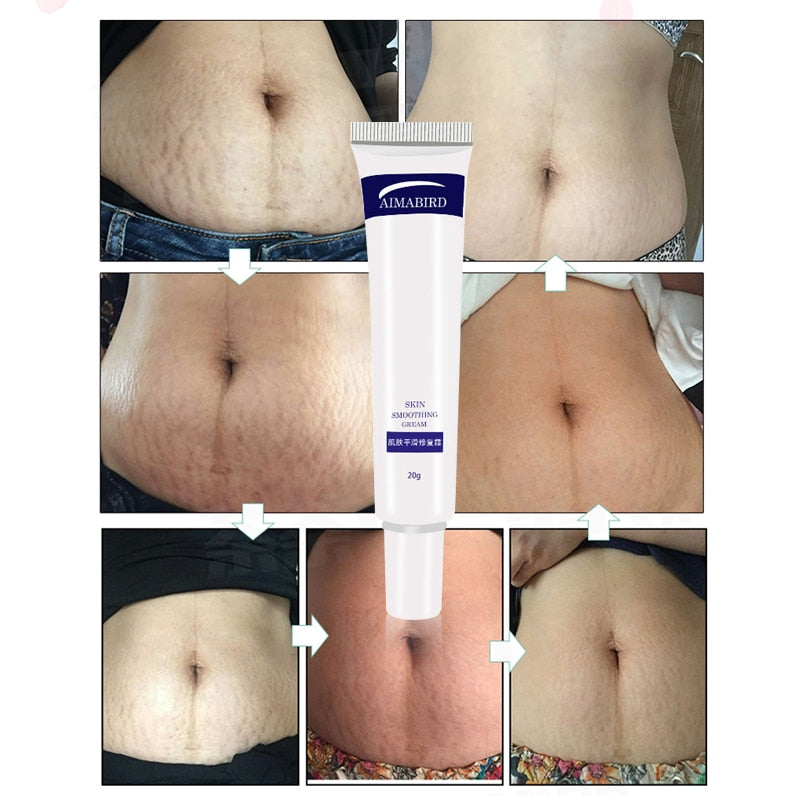 Stretch Mark Cream Skin Repair Duo 20g x 2 by HitMyNeed