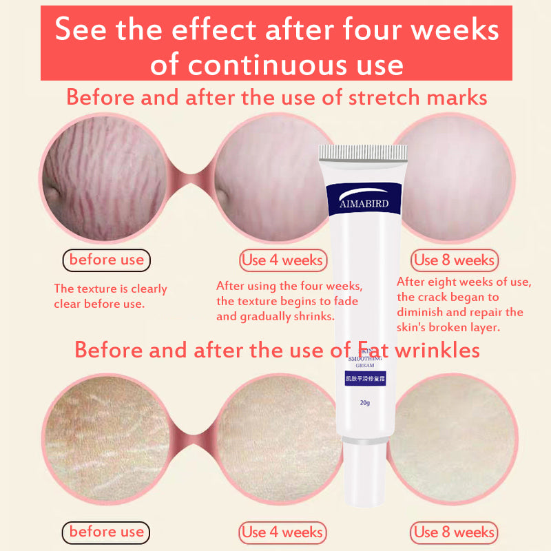 Stretch Mark Cream Skin Repair Duo 20g x 2 by HitMyNeed