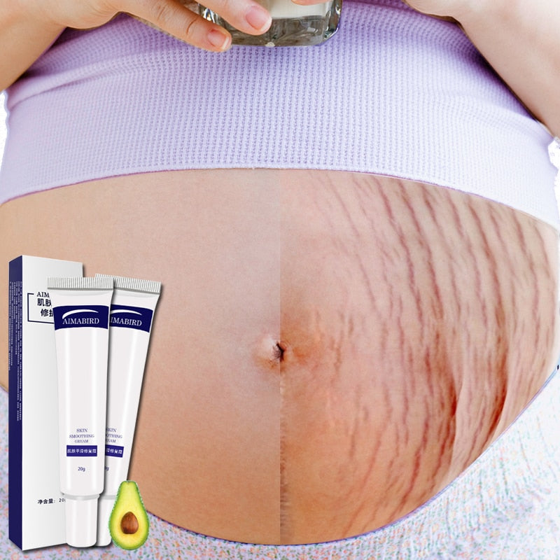 Stretch Mark Cream Skin Repair Duo 20g x 2 by HitMyNeed