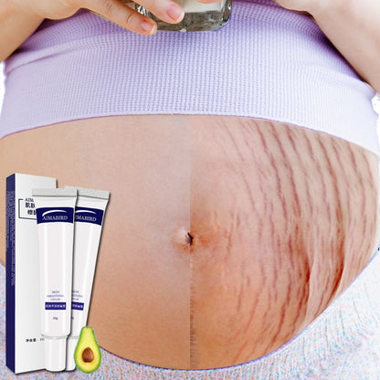 Stretch Mark Cream Skin Repair Duo 20g x 2 by HitMyNeed