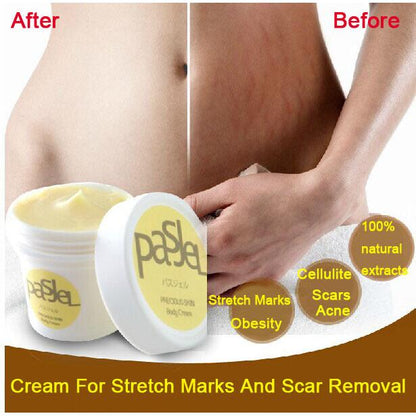 Stretch Mark Reduction Cream with Centella Extract 50g by HitMyNeed