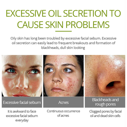 Tea Tree Acne Cream for Clearer Facial Skin 20g by HitMyNeed