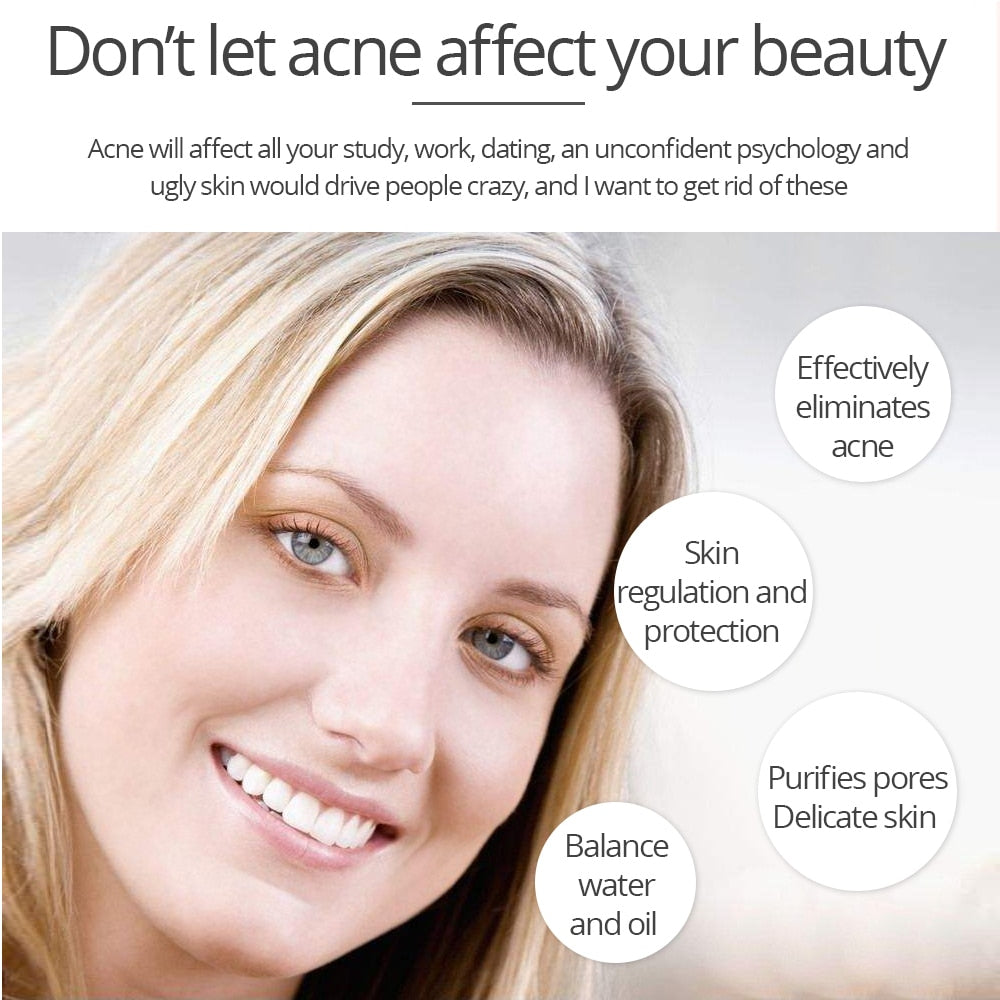 Tea Tree Acne Cream for Clearer Facial Skin 20g by HitMyNeed