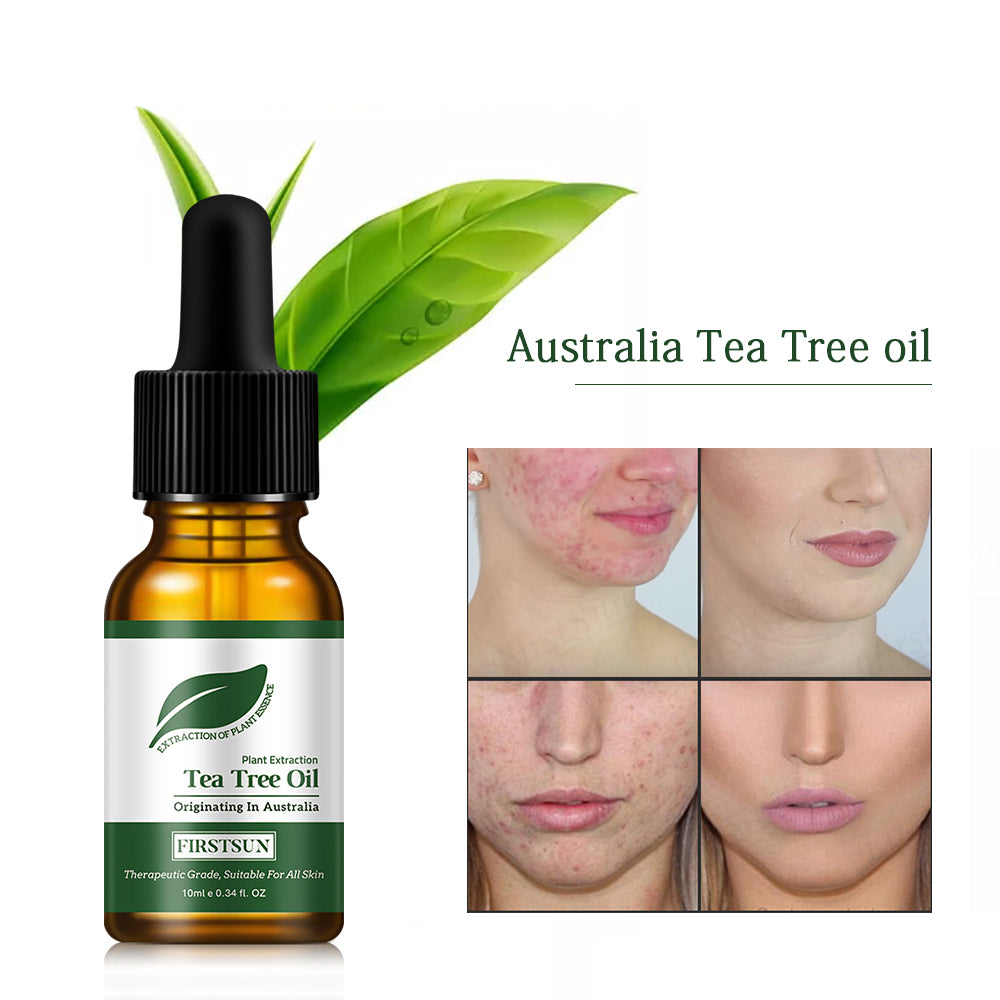 Tea Tree Skin Essential Oil 10ml by HitMyNeed