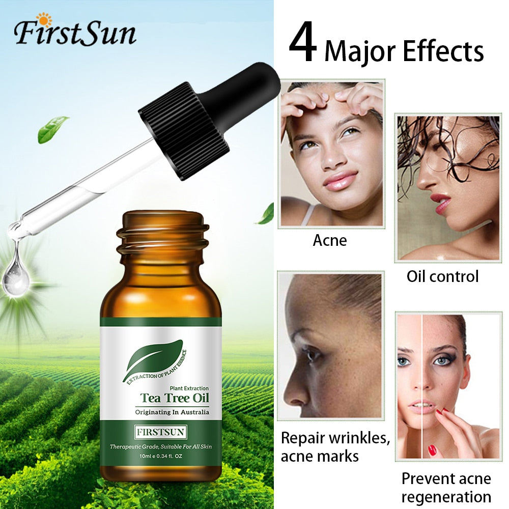 Tea Tree Skin Essential Oil 10ml by HitMyNeed