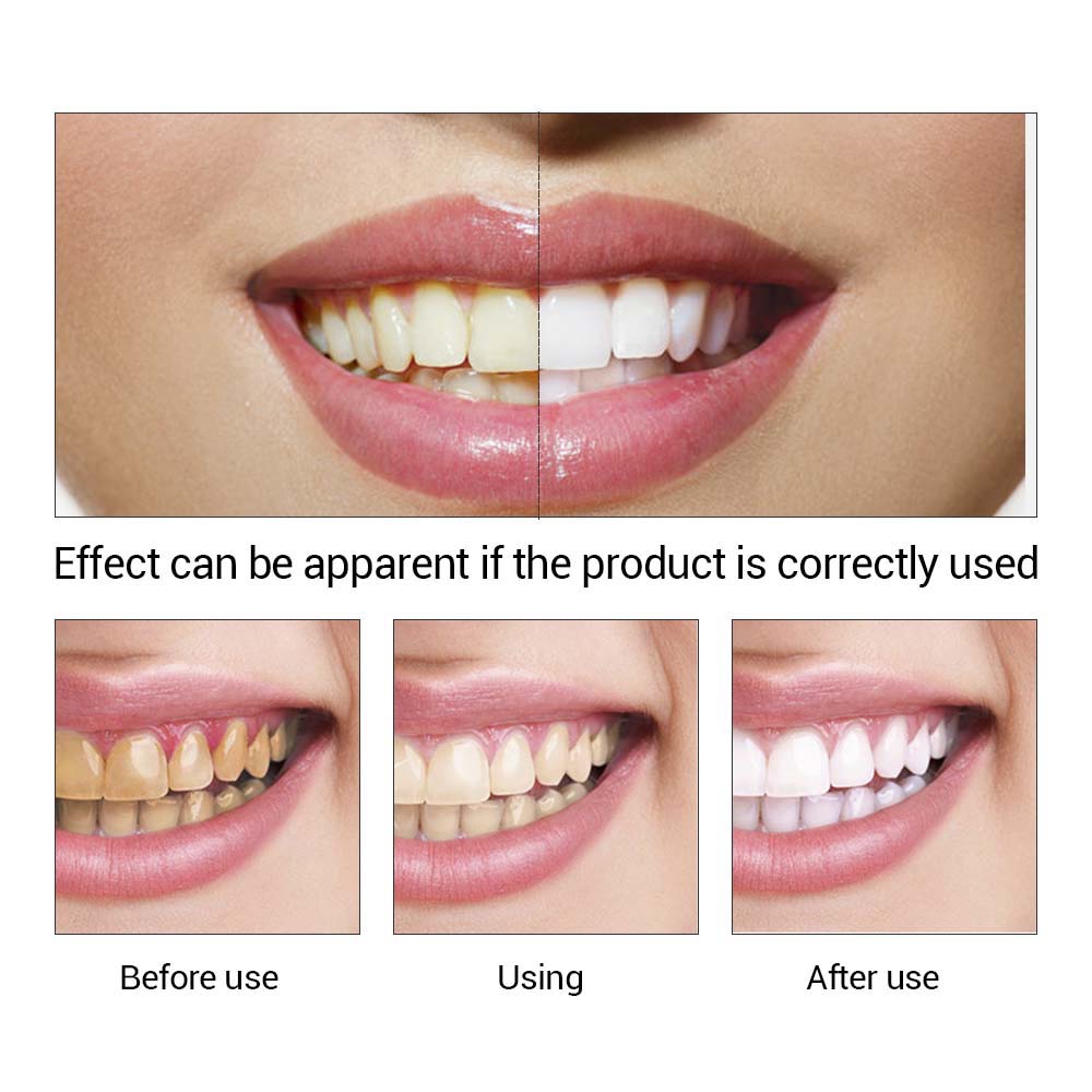 Teeth Whitening & Cleaning Serum by HitMyNeed