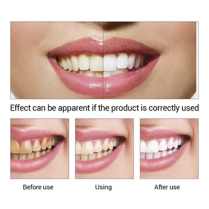 Teeth Whitening & Cleaning Serum by HitMyNeed