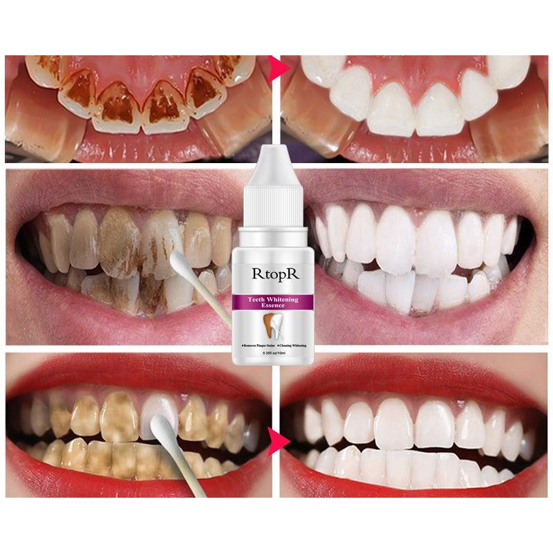 Teeth Whitening Kit Dental Cleanser 10ml by HitMyNeed