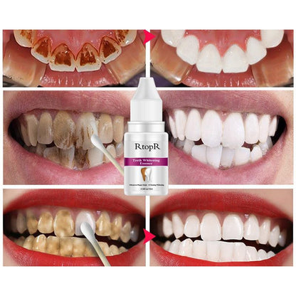 Teeth Whitening Kit Dental Cleanser 10ml by HitMyNeed