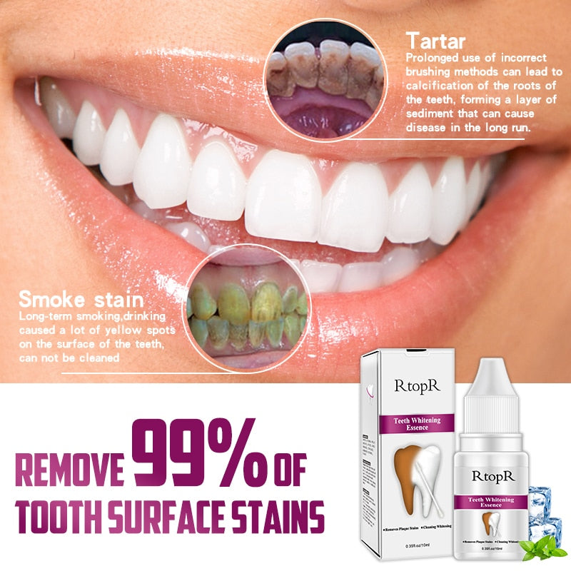 Teeth Whitening Kit Dental Cleanser 10ml by HitMyNeed