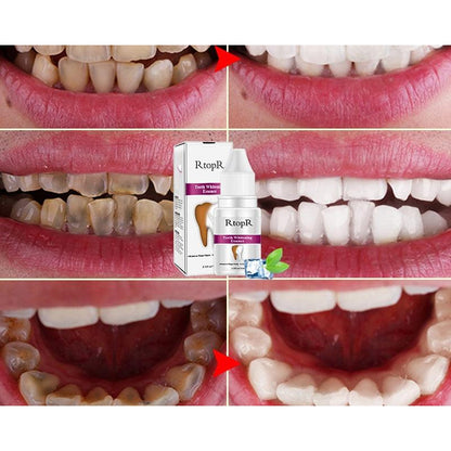 Teeth Whitening Kit Dental Cleanser 10ml by HitMyNeed